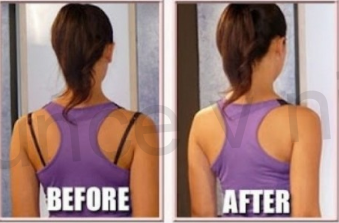 Stahovač ramínek čirá (C84)