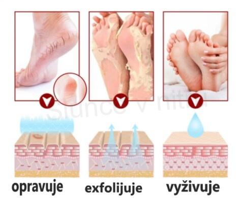Exfoliační ponožky, maska na nohy (F61)