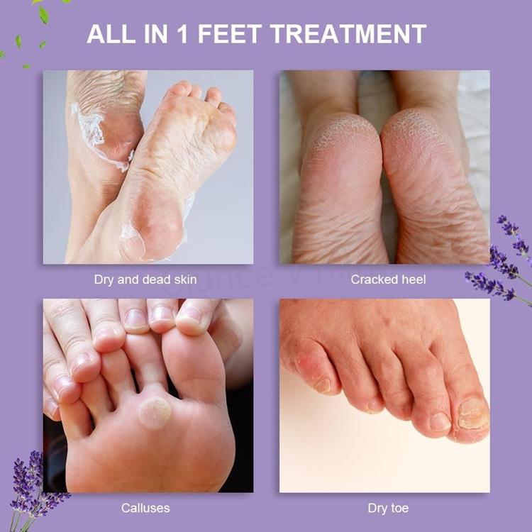 ACWOO Foot Peel Mask – 4 páry exfoliačních ponožek (F95)