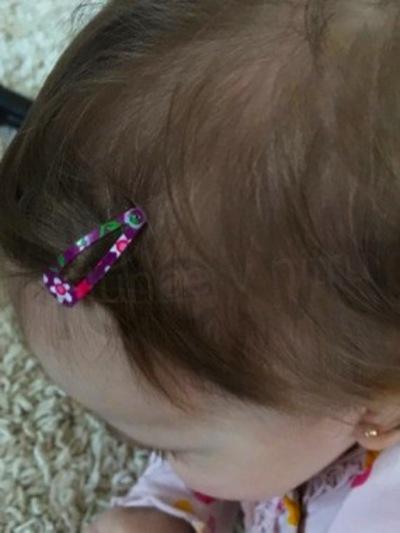 Sponky, sponka do vlasů s potiskem 5 párů číslo 5 (H17)