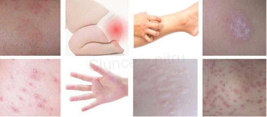 Mýdlo na problematickou pleť mini ( F20)